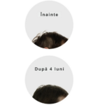 FOLIGAIN – Formula Completa cu Actiune Tripla pentru Par Subtire la Femei, cu 10% TRIOXIDIL - imagine 7