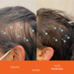 Sampon Refill Impotriva Caderii Parului, Tratament pentru Densitate, Volum si Fortifiere, Par Mai Des si Sanatos, Fara Sulfati si Silicon, Vegan, 500 ml, DS Labs Revita - imagine 9